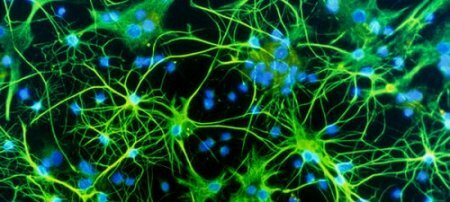 Ученым стал известен механизм восстановления нервных клеток после инсульта